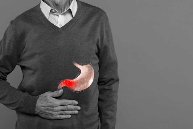 Understanding Heartburn