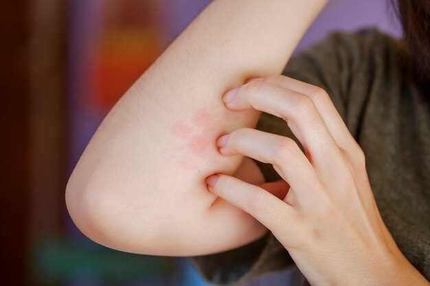 Bupropion side effects skin itching