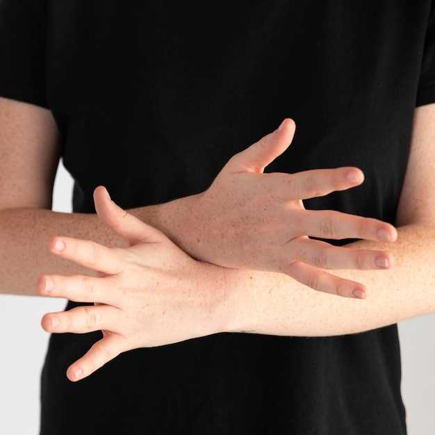 Bupropion swollen hands