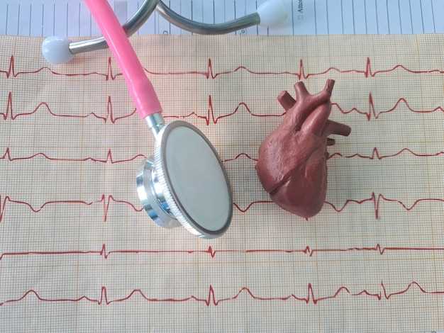 Bupropion tachycardia